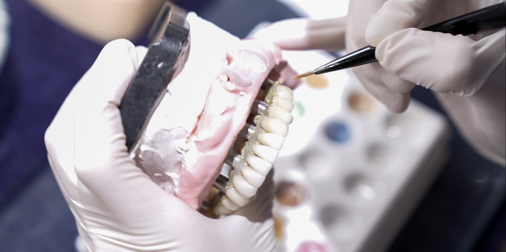 1719193810417644.jpg 牙冠.jpg