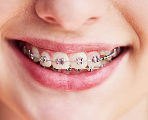 1720055062467691.png 3.png