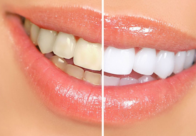 1721005281727513.png 2.png