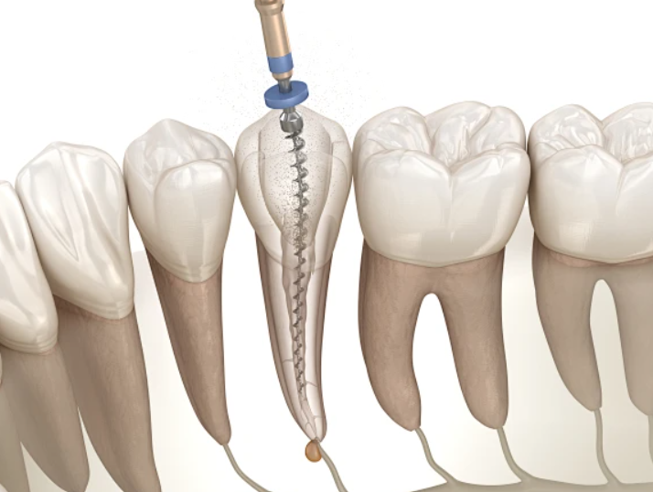 1722563894925550.png 2.png