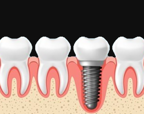 1722992099409520.png 1.png