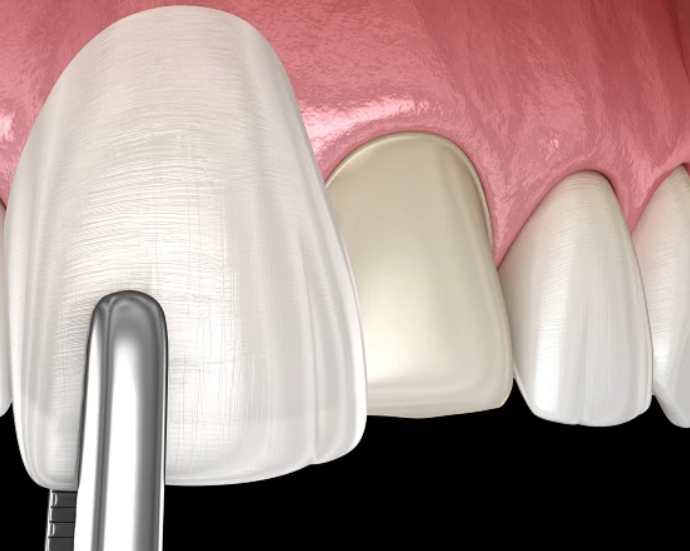 1723080198420157.png 1.png