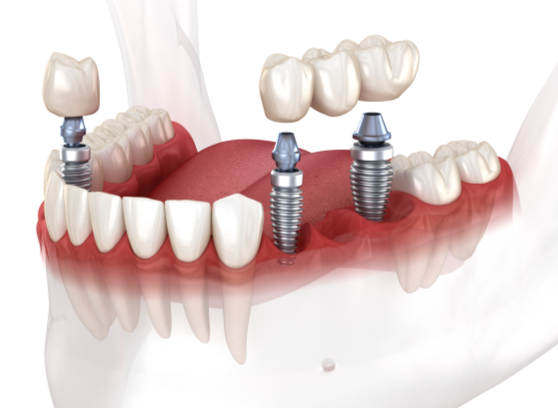 1725689950536189.png 1.png