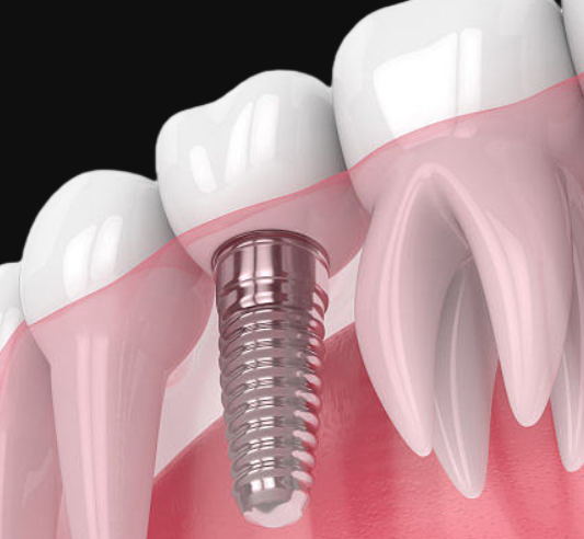 1725937107593309.png 1.png