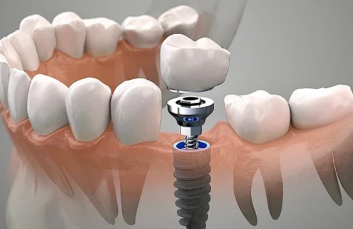 1726195440723677.png 1.png