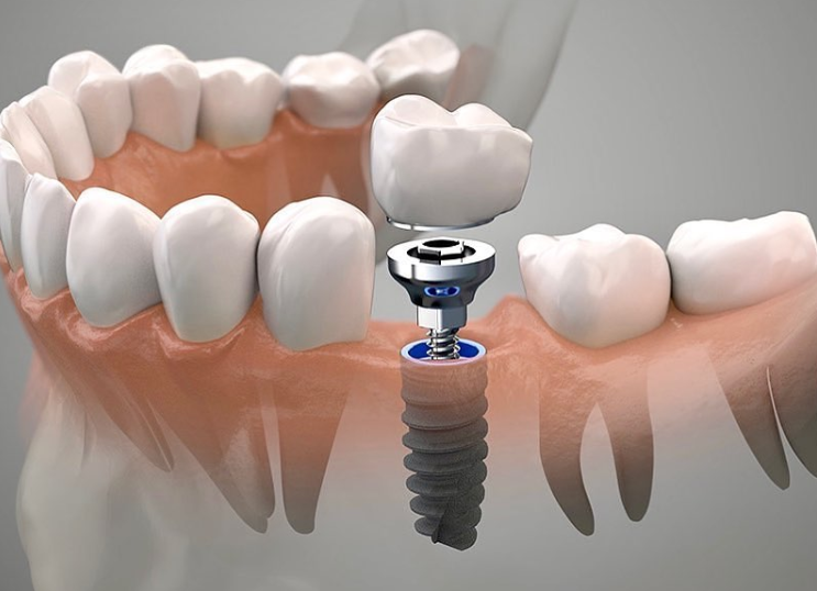 1727142044207263.png 1.png